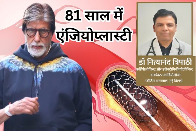 81 साल में अमिताभ बच्चन ने कराई एंजियोप्लास्टी, जानें  कब पड़ती है इसकी जरूरत