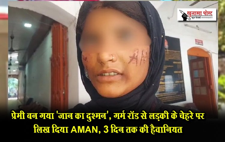प्रेमी बन गया 'जान' का दुश्मन, गर्म रॉड से लड़की के चेहरे पर लिख दिया AMAN, 3 दिन तक की हैवानियत