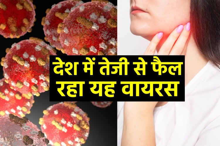 सिरदर्द-बुखार के साथ उड़ गई है भूख? इस वायरस का हो सकता है अटैक