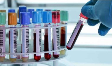 सुर्या पैथोलॉजी लैब में दी खून जांच की गलत रिपोर्ट, डॉक्टर ने इलाज करने से किया  इंकार, मरीज को किया रेफर, जांच के नाम पर स्वास्थ्य से खिलवाड़!