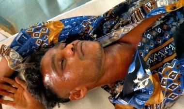 24 कैरेट होटल के पास अज्ञात युवक ने मारा चाकू, अतड़ी बाहर, हालत नाजुक, घायल सिम्स रेफर, आरोपियों की तलाश में जुटी पुलिस