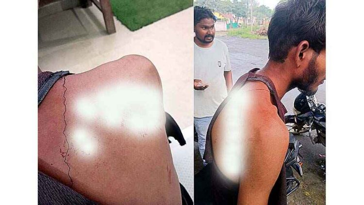 सतनामी समाज अध्यक्ष के बेटे के ऊपर हुआ जानलेवा हमला, चाकूबाजी करने वालों को आखिरकार किसका संरक्षण?