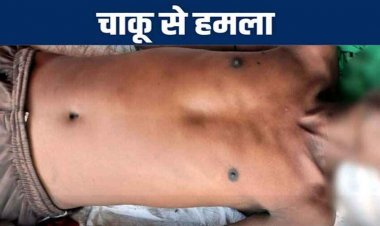 बाइक मांगना पड़ा भारी, आरोपी ने पिता-पुत्र पर चाकू से किया ताबड़तोड़ हमला, झोपड़ी में मिली युवक की लाश, हत्या या हादसा?, जांच में जुटी पुलिस