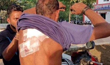 नाबालिग बनते जा रहे चाकूबाज, लड़की से छेड़छाड़ करने से मना करने पर दिनदहाड़े विष्णु पर किया ताबड़तोड़ चाकू से वार, भाई से मारपीट