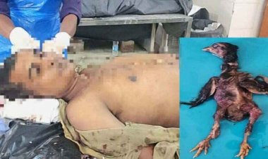 अंधविश्वास से जुड़ी दुखद घटना, जिंदा मुर्गे को निगलने की कोशिश में गले में फसने से युवक और मुर्गा दोनों की हुई मौत, जांच में जुटी पुलिस