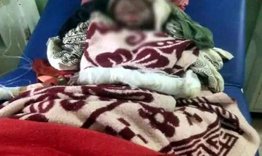 दुकान में अवैध रिफिलिंग के दौरान फटा गैस सिलेंडर, बुरी तरह झुलसा नाबालिग, अस्पताल में भर्ती, हालत नाजुक, आरोपी फरार, जांच में जुटी पुलिस