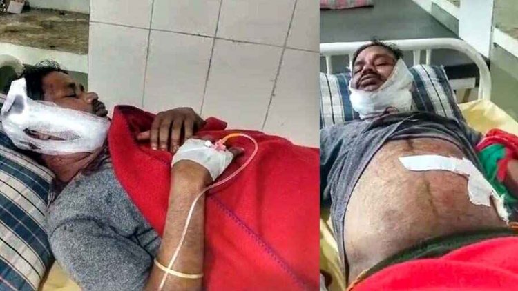 दो पक्षों में विवाद के में बीच-बचाव करने गए व्यक्ति पर नाबालिग ने चाकू से हमला कर किया लहूलुहान, वारदात के बाद आरोपी फरार, तलाश जारी