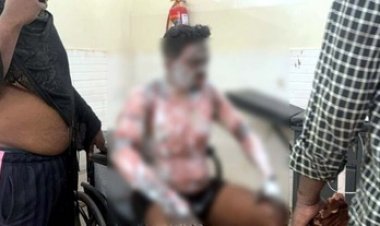 बहन हुई लापता, सदमे में भाई ने खुद को पेट्रोल डालकर किया आग के हवाले, गंभीर रुप से झुलसा, अस्पताल में भर्ती, इलाज के लिए रेफर