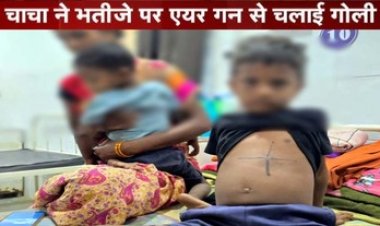 चाचा ने 4 साल के मासूम भतीजे पर एयरगन से किया फायरिंग, डॉक्टरों ने ऑपरेशन कर निकाली पेट में फंसी गोली, आरोपी बिसेश्वर गिरफ्तार