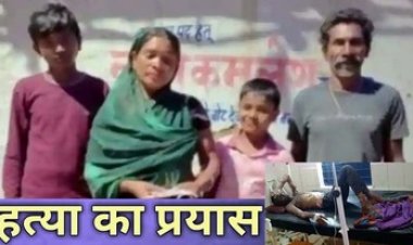 पैरावट में लगी आग की चपेट में झुलसा युवक, हालत नाजुक, पत्नी ने जेठ, ससुर और भतीजे पर लगाया हत्या की कोशिश का आरोप