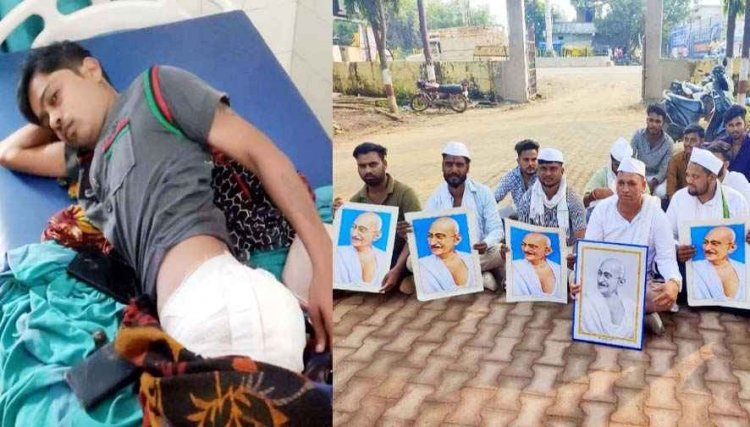 थाना प्रभारी पर बर्बरता का आरोप, लात मारने से आदिवासी युवक के कूल्हे में फूटी शराब की बोतल, घायल का इलाज जारी, कार्यवाही की मांग