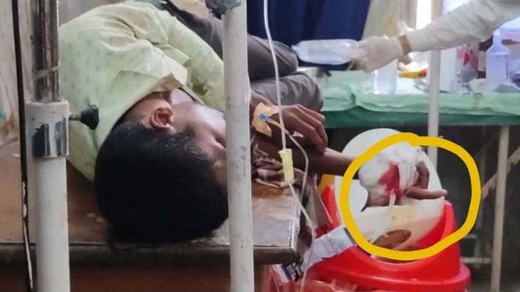 बाप बना बेटे का दुश्मन, पुत्र पर तीर से किया हमला, हाथ में फंसा तीर लेकर युवक रायपुर रेफर, मचा हड़कंप ,आरोपी फरार पिता की तलाश जारी