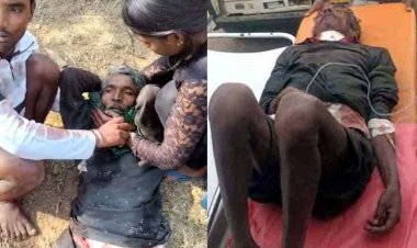 टोकन नहीं कटा-टूटा सब्र, लापरवाही से परेशान किसान ने उठाया खौफनाक कदम, ब्लेड से गला काटने की कोशिश, हालत नाजुक, इलाके में हड़कंप