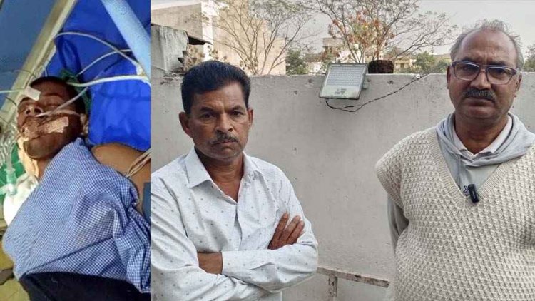 कांग्रेस नेता के करीबी ठेकेदार ने नहीं दिए 57 लाख, मालगाड़ी के सामने कूदा आहत युवक, दाहिना हाथ कटा, हालत नाजुक, जांच में जुटी पुलिस