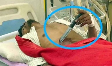 बेखौफ अपराधियों का सरेराह खूनी खेल, दिनदहाड़े चाय दुकान में युवक पर जानलेवा हमला, पेट में फंसा रहा चाकू, तीन आरोपी फरार