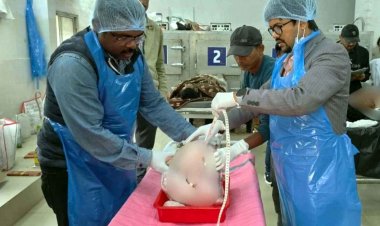 पेट दर्द-बेहोशी के बाद मौत, पोस्टमॉर्टम में चौंकाने वाला खुलासा, महिला के पेट से निकला 11 किलो का ट्यूमर, डॉक्टर भी रह गए दंग, दी चेतावनी