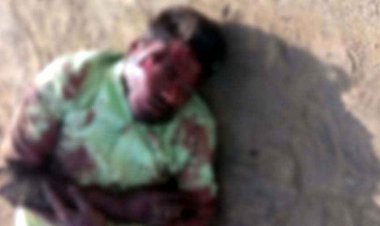 दर्दनाक सड़क हादसा, आंख में जा घुसी गाय की सींग, प्रैक्टिकल परीक्षा देने जा रहे बाइक सवार युवक की हालत नाजुक, इलाके में चिंता का माहौल