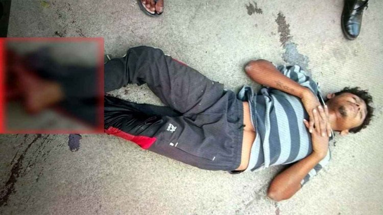 रायपुर में पारिवारिक विवाद ने ले लिया हिंसक रुप, बाप ने बेटे पर चाकू से किया जानलेवा हमला, बेटा एम्स में भर्ती, जांच में जुटी पुलिस