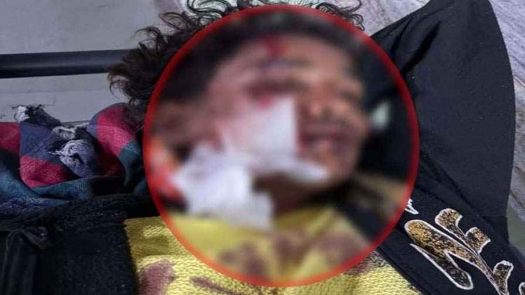 दर्दनाक सड़क हादसा, दो बाइक की टक्कर में 18 वर्षीय युवक घायल, इलाज के लिए भर्ती, आरोपी चालक फरार, जांच में जुटी पुलिस