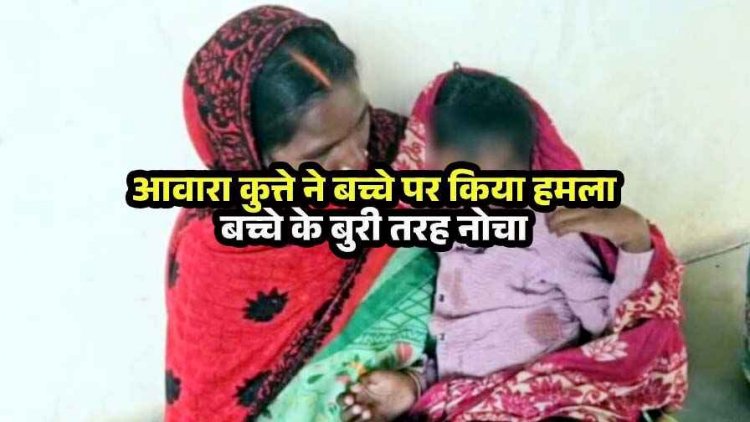 आवारा कुत्तों का बढ़ रहा आतंक, स्कूल जा रहे मासूम को कुत्ते ने बुरी तरह नोचा, नाजुक हालत में अस्पताल में भर्ती, इलाके में दहशत का माहौल