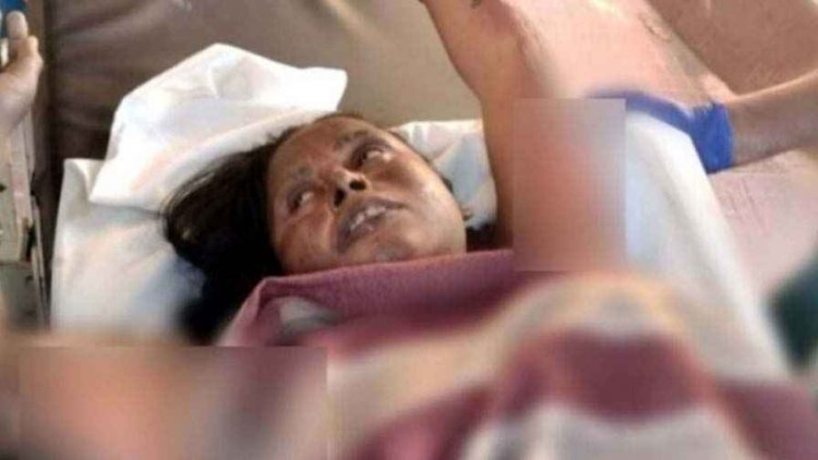 भक्ति के दौरान भीषण हादसा, पूजा करते समय दिये से झुलसी महिला, हालत नाजुक, अस्पताल में लड़ रही जिंदगी और मौत के बीच की जंग