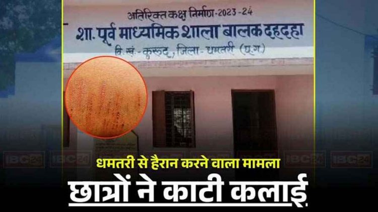 सरकारी स्कूल के 35 बच्चों ने ब्लेड से काटी कलाई, प्राचार्य और HM को शिक्षा विभाग ने जारी किया नोटिस, तीन दिन में मांगा जवाब