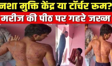नशा मुक्ति केंद्र में भर्ती आदिवासी युवक की पाइप से चमड़ी उखड़ते तक पिटाई, पीठ-गर्दन पर गहरे जख्म, बिगड़ी मानसिक हालत, वीडियो वायरल, FIR दर्ज