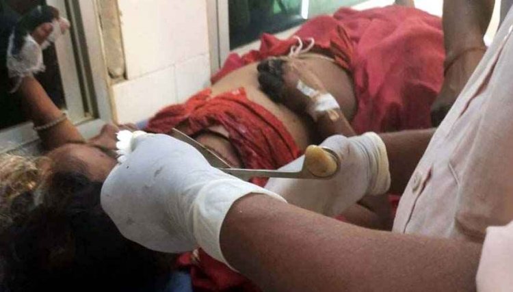 झाड़ियों में छिपा मौत का साया, महुआ बीन रही महिला पर अचानक टूट पड़ा जंगली सूअर, इलाके में दहशत का माहौल, आजीविका का साधन बना जानलेवा