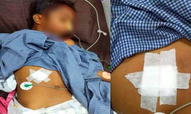 रायपुर के गोकुल नगर में नाबालिग का हाफ मर्डर, मंदिर परिसर में चाकूबाजी, अस्पताल में भर्ती, हालत नाजुक, वारदात CCTV में कैद, आरोपी की तलाश में जुटी पुलिस