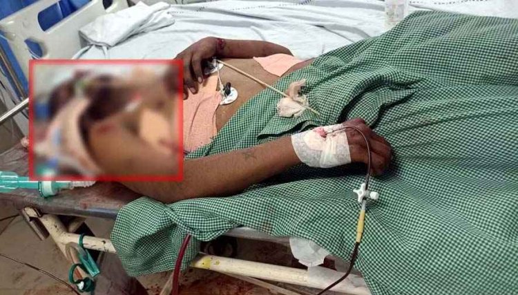 एक्टिवा लेन-देन विवाद को लेकर चाकूबाजी, युवक की हालत नाजुक, प्राइवेट अस्पताल में भर्ती, इलाके में दहशत का माहौल, पुलिस की हिरासत में 2 संदेही