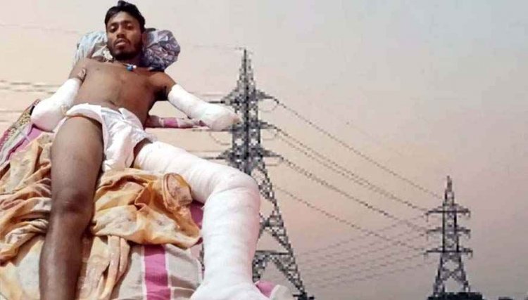 करंट से घायल महावीर के कट गए दोनों हाथ, पैसे कटने की तैयारी, इलाज कराने बेची जमीन, नहीं मिली सरकारी सहायता और आयुष्मान योजना का लाभ