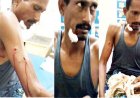 खेत में काम कर रहे ग्रामीण पर तेंदुए का हमला, गंभीर घायल, सूझबूझ से बची जान,  पाण्डुका वन क्षेत्र में दहशत, वन विभाग की कार्यप्रणाली पर सवाल