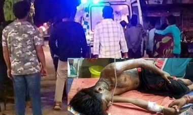 धमतरी में ‘एसिड अटैक’ से दहशत, मामूली विवाद ने लिया खौफनाक मोड़, तेजाब फेंककर जिंदा जलाने की कोशिश, नाबालिग गंभीर, आरोपी फरार
