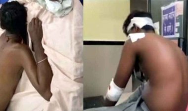 मामूली विवाद ने लिया हिंसक रूप, ज्यादा गुपचुप खिलाने को लेकर नाराज ग्राहक ने  पिता-पुत्र पर चाकू से किया जानलेवा हमला, जांच में जुटी पुलिस