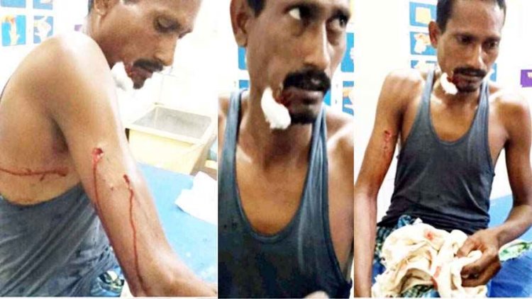 खेत में काम कर रहे ग्रामीण पर तेंदुए का हमला, गंभीर घायल, सूझबूझ से बची जान,  पाण्डुका वन क्षेत्र में दहशत, वन विभाग की कार्यप्रणाली पर सवाल