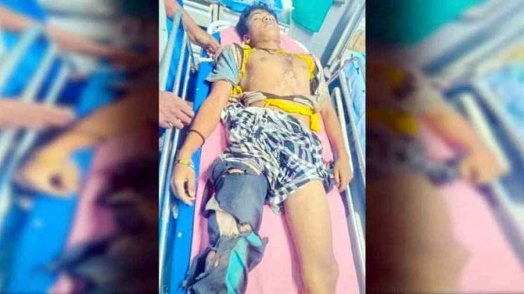 आकाशीय बिजली गिरने से हाईटेंशन लाइन के नीचे खेल रहे 1 8 वर्षीय इकलौते बेटे की दर्दनाक मौत, परिवार में पसरा मातम, लोगों में दहशत का माहौल