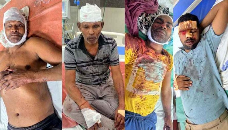 जमीन विवाद में भाइयों के बीच खूनी संघर्ष, बंटवारे को लेकर विवाद, लाठी-डंडे और कुल्हाड़ी से हमला, छह लोग घायल, काउंटर केस दर्ज, जांच में जुटी पुलिस