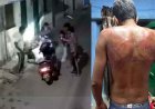 स्कूटी में दवा लेने जा रही बहन से छेड़छाड़, विरोध कर रहे भाई की बेरहमी से पिटाई, वीडियो आया सामने, 5 लोगों के खिलाफ मामला दर्ज, जांच में जुटी पुलिस