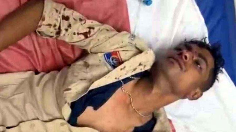 बाप-बेटे की लड़ाई शांत कराना सिपाही को पड़ा भारी, पिता पर चाकू लेकर दौड़ा बेटा, पुलिस पहुंची तो आरक्षक पर कर दिया हमला, जवान हमले से लहूलुहान