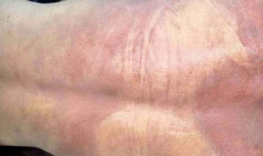 18 वर्षीय बेटे ने की आत्महत्या, सदमे में परिवार, आरक्षक ने पुलिसकर्मियों पर लगाया प्रताड़ना का आरोप, पुलिस अधीक्षक से लगाई इंसाफ की गुहार