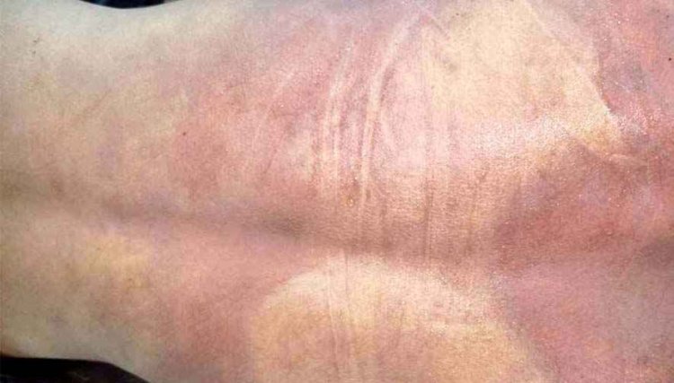 18 वर्षीय बेटे ने की आत्महत्या, सदमे में परिवार, आरक्षक ने पुलिसकर्मियों पर लगाया प्रताड़ना का आरोप, पुलिस अधीक्षक से लगाई इंसाफ की गुहार
