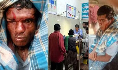 गरियाबंद में भालू का हमला: शौच के लिए गए ग्रामीण गंभीर घायल, आंखों के ऊपर पंजे और नाखून से गहरे जख्म, रेंजर सुशील सागर ने पहुंचाया हॉस्पिटल