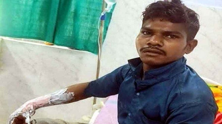 पत्नी पर कमेंट, दोस्त को जिंदा जलाने की कोशिश, युवक ने पेट्रोल डालकर लगाई आग, पीड़ित ने तालाब में कूदकर बचाई जान, आरोपी लीला गिरफ्तार