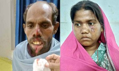 कुत्ते ने ग्रामीणों पर किया हमला, हमले से दो ग्रामीण घायल, हालत नाजुक, गरियाबंद जिला अस्पताल रेफर, गांव में अफरा-तफरी का माहौल