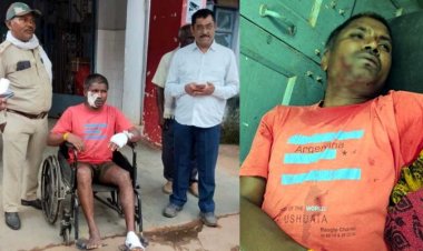 खेत में खाद छिड़कने गए किसान पर बाघ का हमला!, लोहे के घमेला से बचाई जान, हाथ-पैर और चेहरे पर पंजों के निशान, छह गांवों में सतर्क रहने की मुनादी