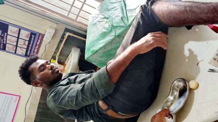 मैनपुर में दो बाइक की जोरदार टक्कर, 23 वर्षीय युवक गंभीर घायल, 112 टीम ने पहुंचाया अस्पताल, इलाज जारी, जांच में जुटी पुलिस